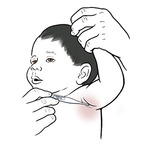 Primer plano de un adulto levantando el brazo de un bebé para colocar el termómetro digital en la axila.