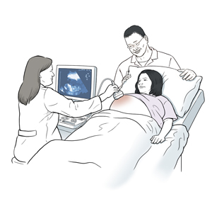 Mujer embarazada a la que le están haciendo un ecocardiograma fetal. Hay un hombre en un extremo de la mesa de examen y un técnico realizando la prueba.