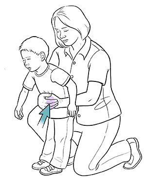Woman doing choking rescue maneuver on toddler boy.
