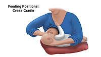 Illustration of breastfeeding, cross-cradle position