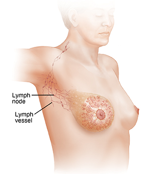 Three-quarter view of female head, neck, and chest with raised right arm showing axillary lymph nodes.