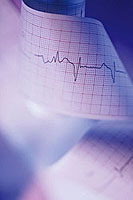 Foto de una tira del electrocardiograma