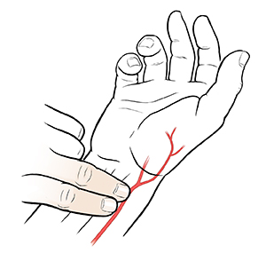 Mano con la palma hacia arriba donde se observa la ubicación de la arteria radial. Dos dedos de la mano contraria tomando el pulso radial.