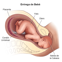 Ilustración del parto del bebé